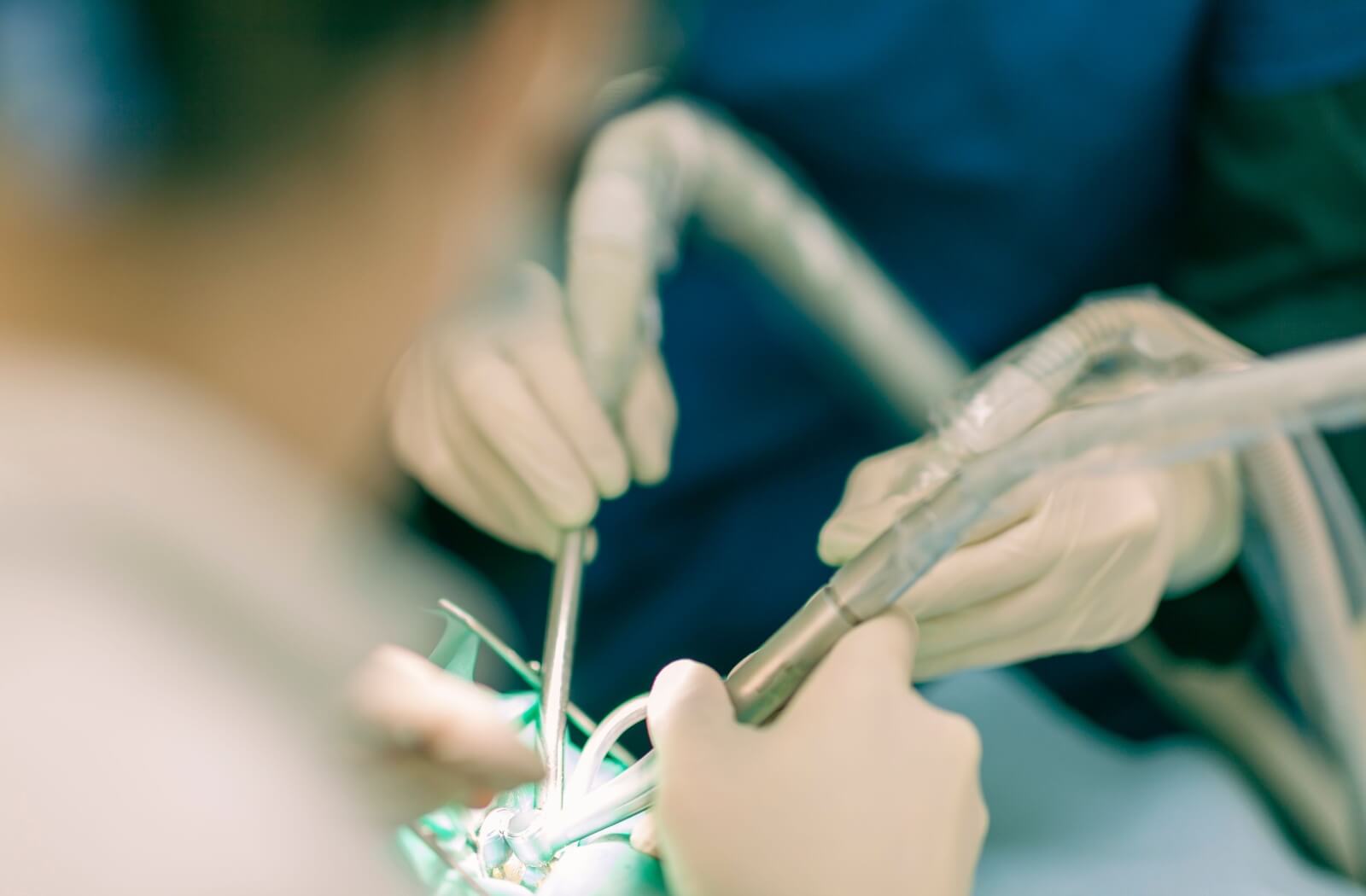  a close-up photo of a dentist performing root canal treatment on a patient under anesthesia