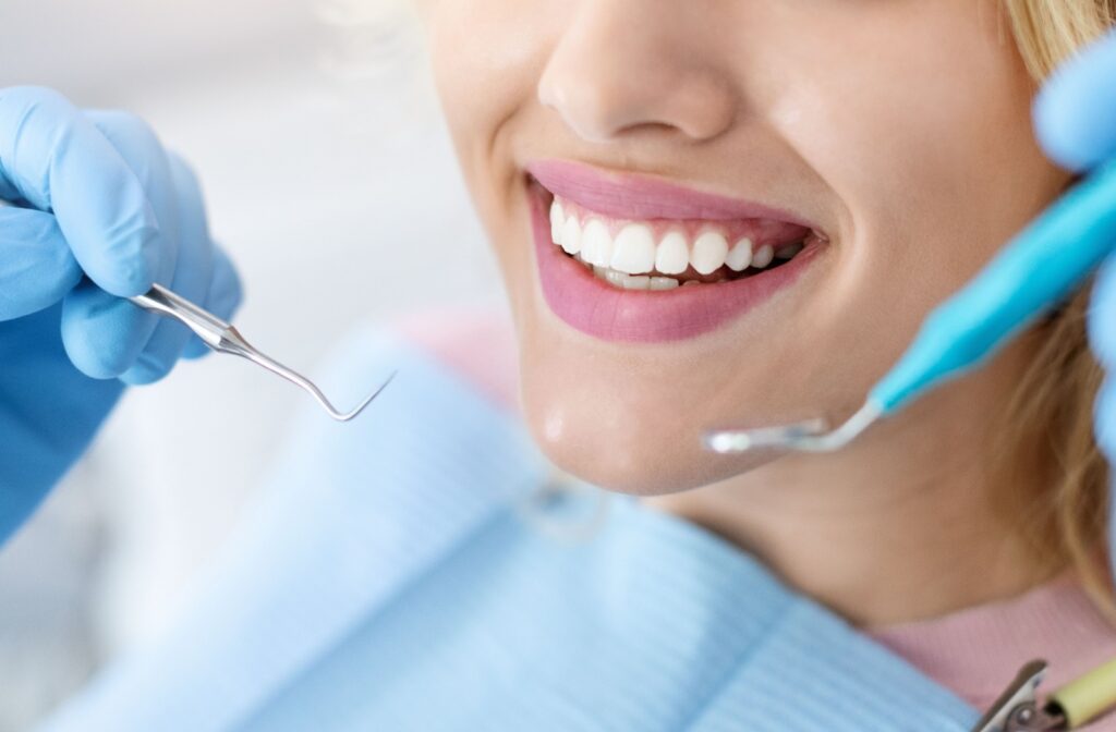 Close-up of a patient smiling after a whitening treatment with dental tools visible near their mouth.