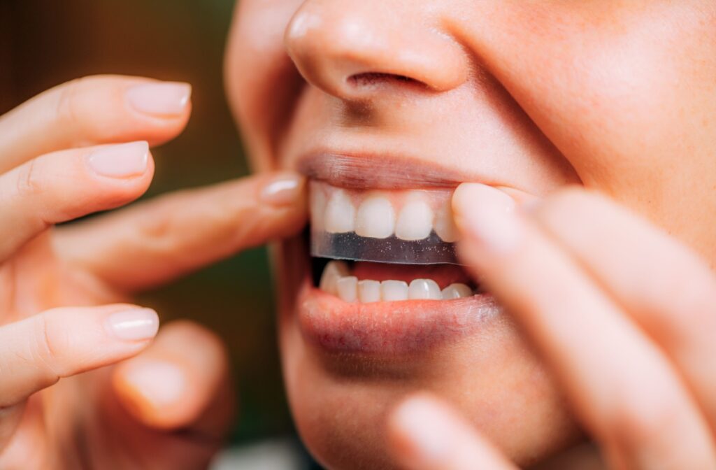 Close-up of a person applying an at-home whitening strip to their upper teeth.