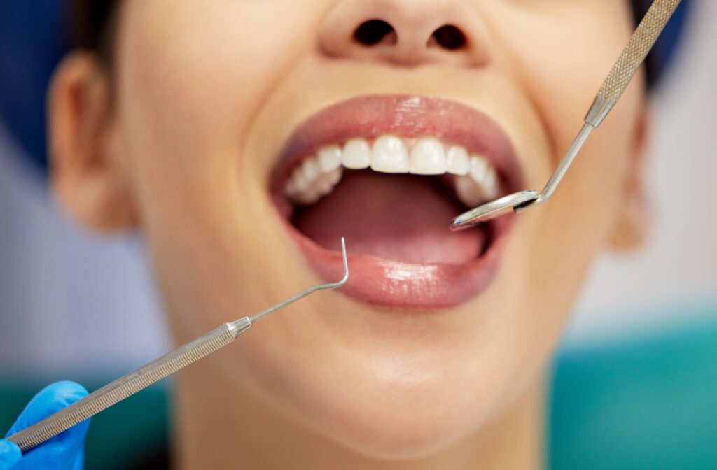 A close up of a patient at the dentist having a routine dental cleaning.